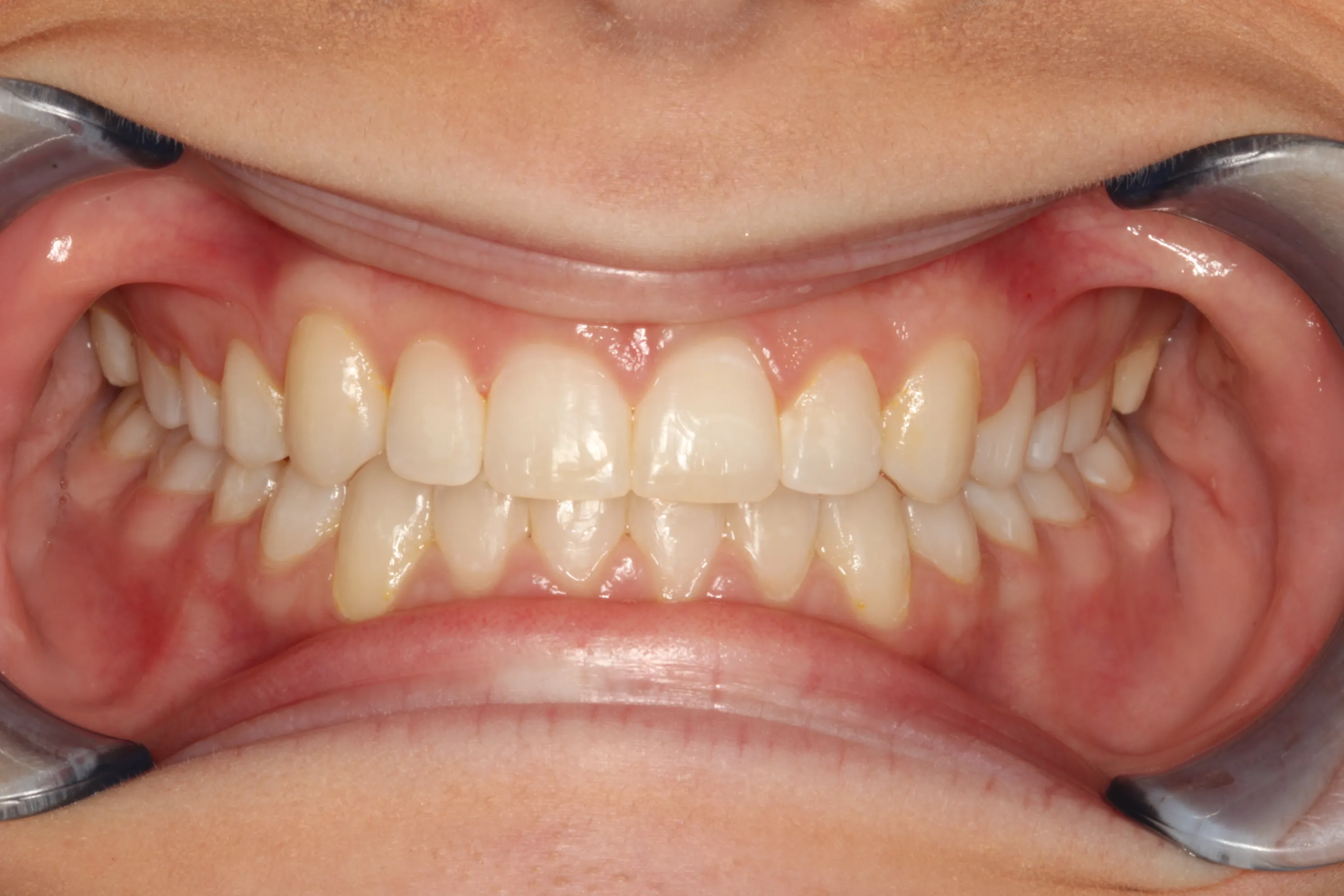 smile-gallery gallery